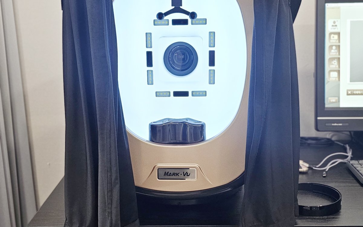 CO2 fractional laser suite for scar treatment at Newve Skin Clinic