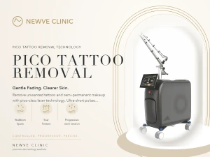 Pico Laser Tattoo Removal