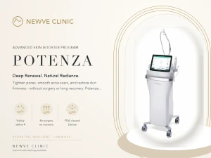 Potenza RF Microneedling