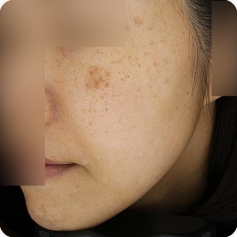 Before treatment
