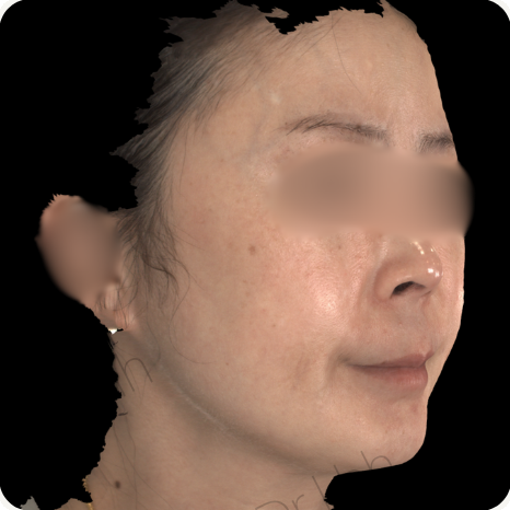 Before treatment